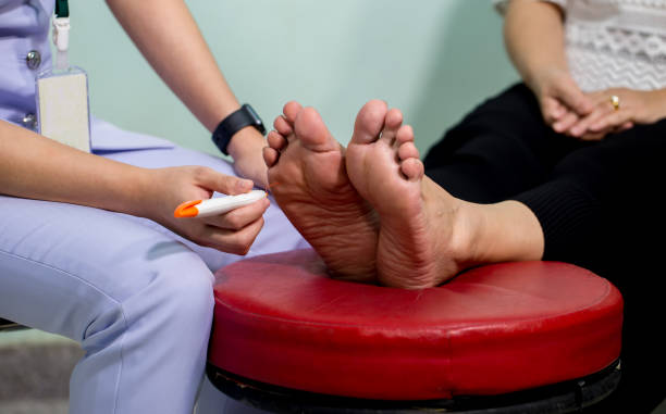 What is the Monofilament Test for Diabetic Neuropathy