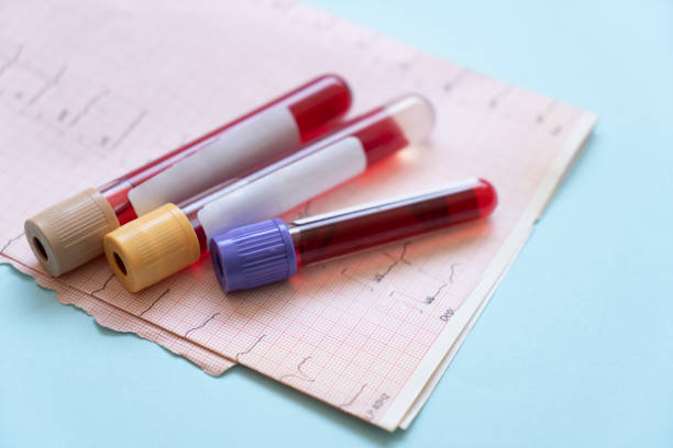 What Tube Is Used for Blood Collection