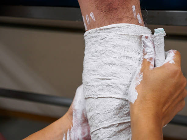 Everything You Need to Know About Plaster of Paris Bandage